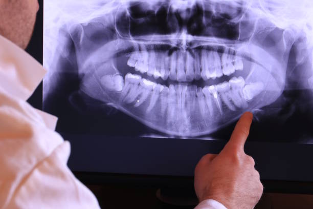 Best Emergency Tooth Extraction in Carlisle Rockledge, AL