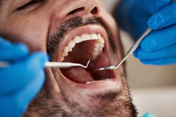 Best Emergency Broken Tooth Repair in Carlisle Rockledge, AL